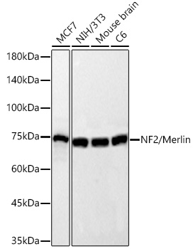  NF2/Merlin Rabbit mAb 