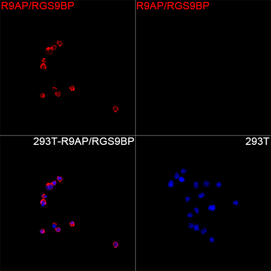  R9AP/RGS9BP Rabbit mAb 