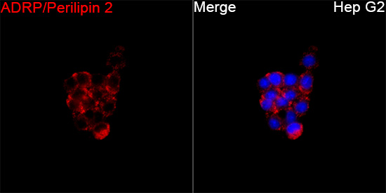  ADRP/Perilipin 2 Rabbit mAb 