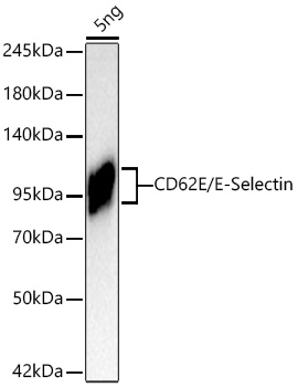  CD62E/E-Selectin Rabbit mAb 