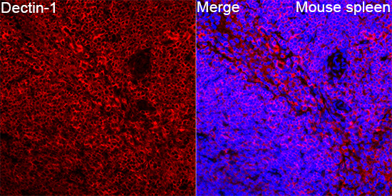  Dectin-1 Rabbit mAb 