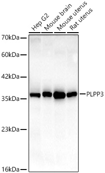  PLPP3 Rabbit mAb 