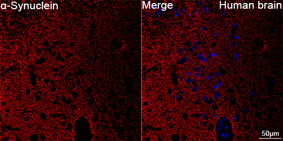  _-Synuclein Rabbit mAb 