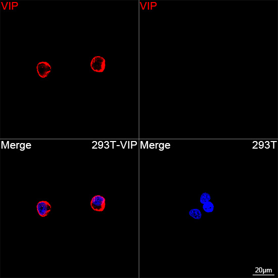  VIP Rabbit mAb 