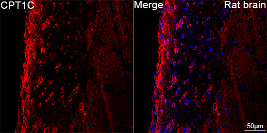  CPT1C Rabbit mAb 