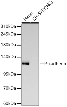  P-cadherin Rabbit mAb 