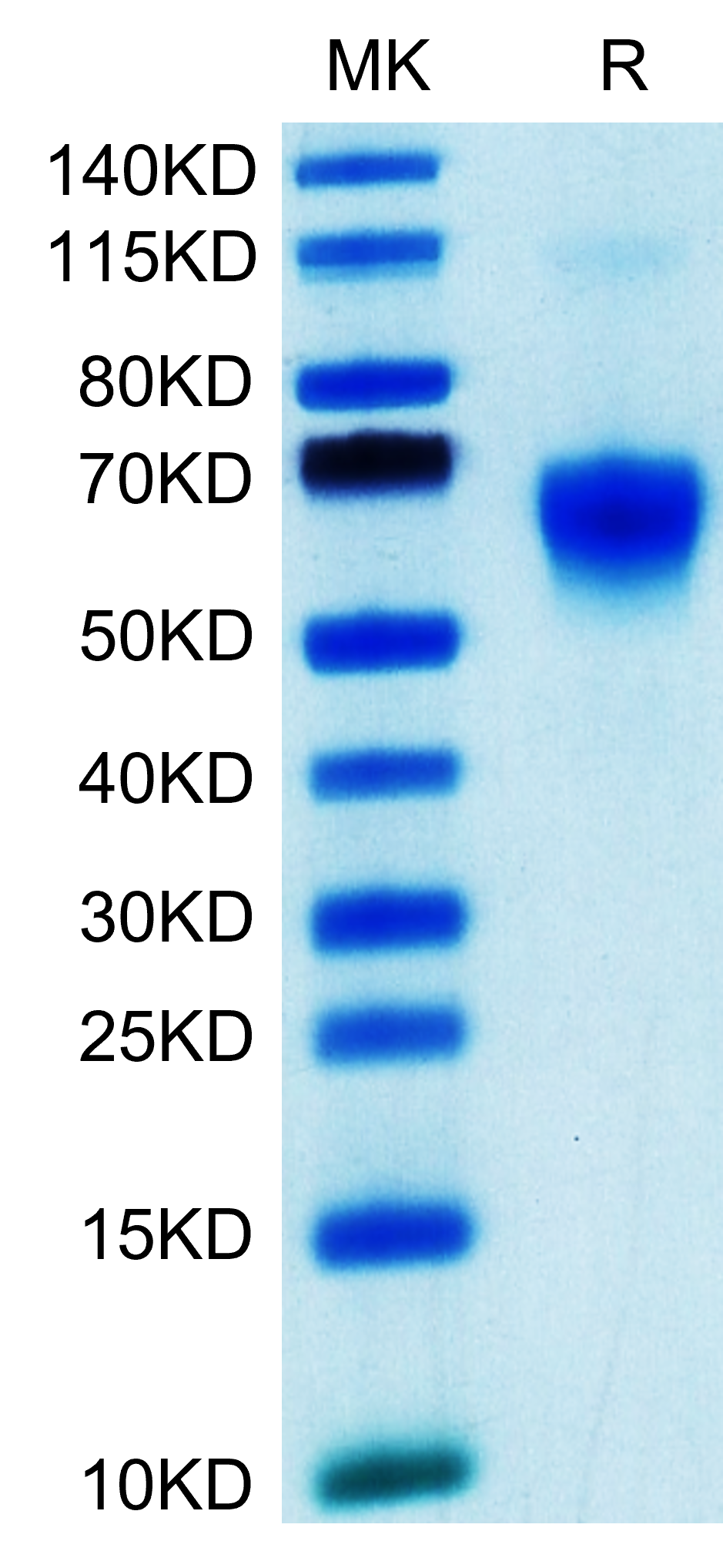 Human Galectin 9/LGALS9 Protein (LTP10760)